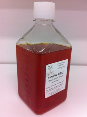 Donor Bovine Serum